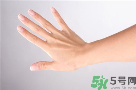 手干裂口子怎么回事？手干裂口子怎么辦？