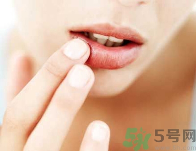 孕婦嘴唇干裂脫皮怎么回事？孕婦嘴唇干裂脫皮是缺什么