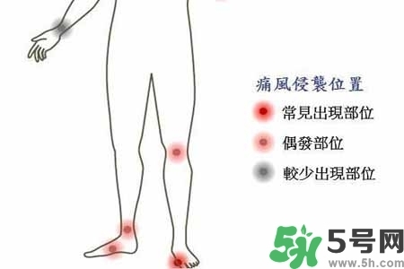 引發(fā)痛風(fēng)的原因是什么？痛風(fēng)病人飲食需注意什么好？