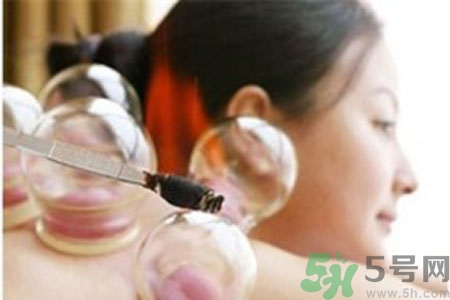 月經(jīng)可以拔火罐嗎？經(jīng)期可以拔火罐嗎？