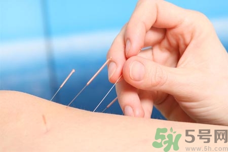 針灸一次要扎多長(zhǎng)時(shí)間？針灸可以幾天做一次？