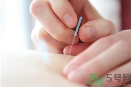 針灸一次要扎多長(zhǎng)時(shí)間？針灸可以幾天做一次？