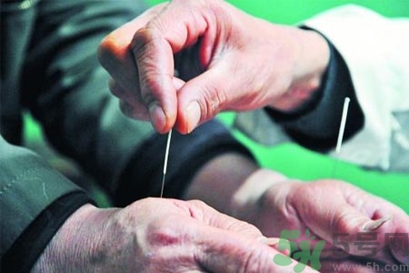 針灸一次要扎多長(zhǎng)時(shí)間？針灸可以幾天做一次？