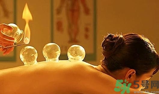 在家拔罐需要注意什么？在家拔罐幾天拔一次？
