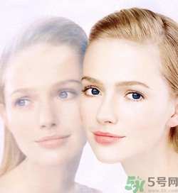 曬斑可以自己消退嗎？曬斑可以用激光去除嗎？