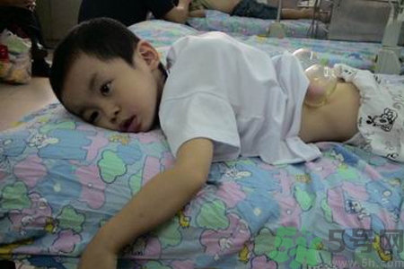 小孩可以拔罐嗎？寶寶能拔火罐嗎？