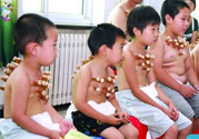 小孩可以拔罐嗎？寶寶能拔火罐嗎？