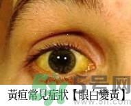 上腹部不舒服有時疼痛會不會是胰臟癌？