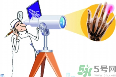 什么年齡測骨齡最好？如何測骨齡？