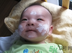 新生兒濕疹可以用爐甘石洗劑嗎？新生兒濕疹的護(hù)理措施