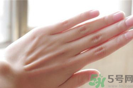 患凍瘡是身體缺什么嗎？長(zhǎng)凍瘡是身體缺維生素嗎？