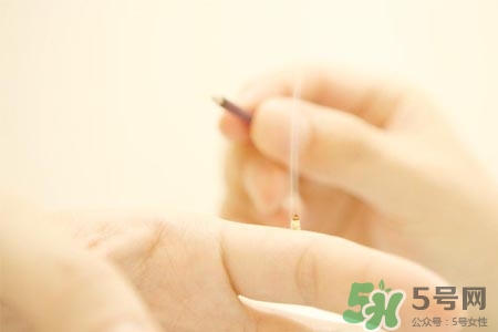 面癱能艾灸嗎？艾灸能治療面癱嗎？
