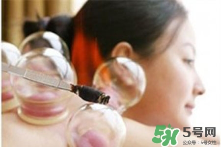 拔罐放血對身體好嗎？拔罐放血有什么好處？