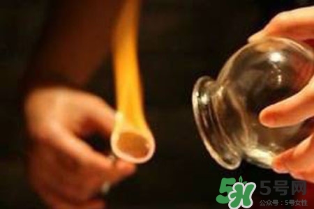 拔罐放血對身體好嗎？拔罐放血有什么好處？