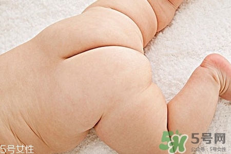 擴(kuò)肛有什么好處？擴(kuò)肛需要注意什么？