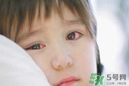 孩子為什么老眨眼睛？孩子總眨眼睛怎么回事？
