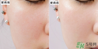 holika懶蛋蛋去角質(zhì)多少錢(qián)？holika雞蛋去角質(zhì)啫喱價(jià)格