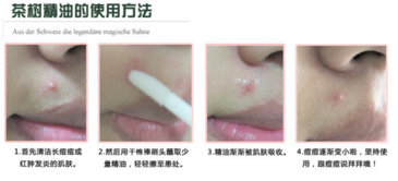 the body shop茶樹(shù)精油怎么用？美體小鋪茶樹(shù)精油怎么打開(kāi)