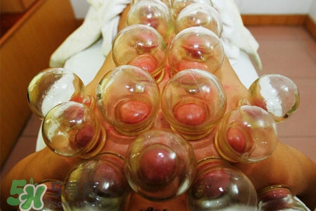 拔罐后皮膚發(fā)癢是怎么回事？拔罐后為什么皮膚會(huì)癢？