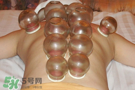 拔火罐后皮膚癢擦什么？拔火罐后皮膚癢怎么辦？