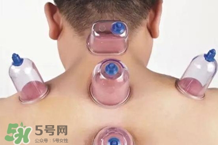 拔罐后可以喝酒嗎？拔罐后多久能喝酒？