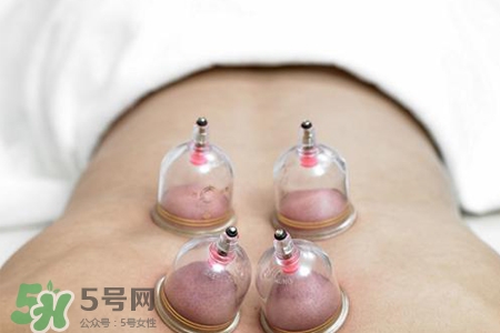 拔罐后可以泡澡嗎？拔罐后多久能泡澡？