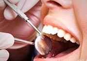 拔牙之后可以吃藥嗎？拔牙之后要不要吃藥？