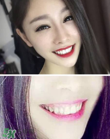 碧緹福冷光牙齒美白儀怎么用？碧緹福冷光牙齒美白儀使用方法