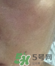 skin1004是什么牌子？skin1004屬于什么檔次