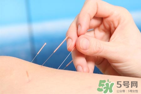 腰間盤突出可以針灸嗎？針灸能治腰間盤突出嗎？