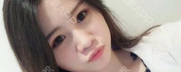 定點(diǎn)雙眼皮能保持多久？定點(diǎn)雙眼皮是永久的嗎？