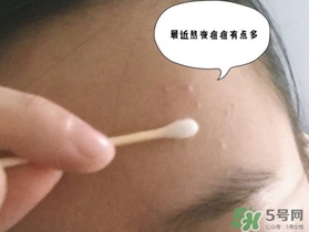 星期四農(nóng)莊茶樹精油怎么用？星期四農(nóng)莊茶樹精油使用方法