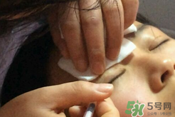 埋線雙眼皮需要拆線嗎？埋線雙眼皮怎么拆線