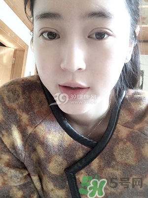 什么是定點雙眼皮？定點雙眼皮多少錢？