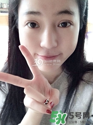 什么是定點雙眼皮？定點雙眼皮多少錢？