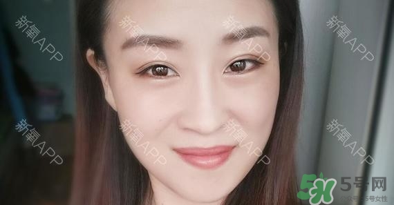 埋線雙眼皮能保持多久？埋線雙眼皮是永久嗎
