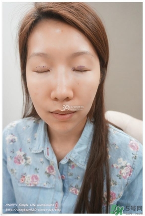 重瞼術(shù)多久能完全消腫 重瞼術(shù)恢復過程圖