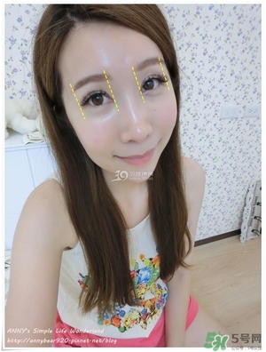 重瞼術(shù)多久能完全消腫 重瞼術(shù)恢復過程圖