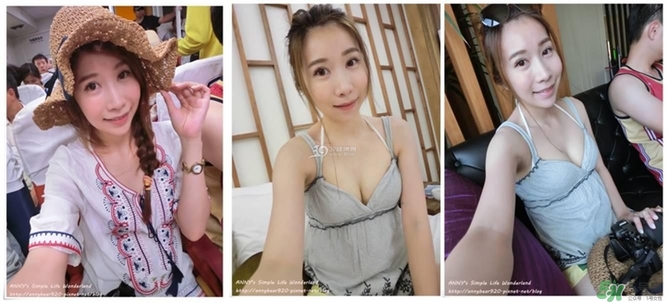 重瞼術(shù)多久能完全消腫 重瞼術(shù)恢復過程圖