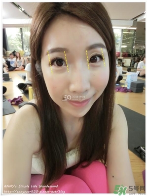 重瞼術(shù)多久能完全消腫 重瞼術(shù)恢復過程圖