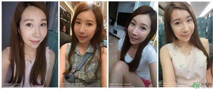 重瞼術(shù)多久能完全消腫 重瞼術(shù)恢復過程圖