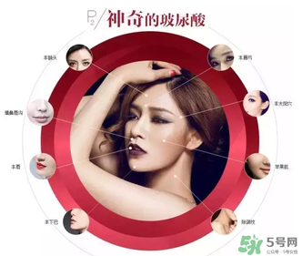 喬雅登是哪個(gè)國(guó)家的？喬雅登玻尿酸哪個(gè)國(guó)家？