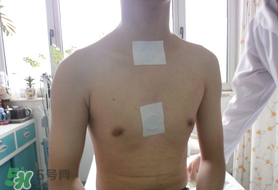 三九貼怎么貼？三九貼的貼法