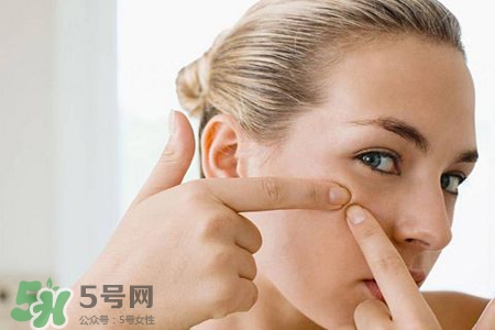 膠原蛋白能祛痘嗎？膠原蛋白可以祛痘嗎？