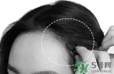 發(fā)際線高適合什么發(fā)型？發(fā)際線高怎么辦