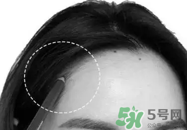 發(fā)際線高適合什么發(fā)型？發(fā)際線高怎么辦