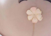 妊娠線每個(gè)孕婦都有嗎？妊娠線出現(xiàn)的時(shí)間