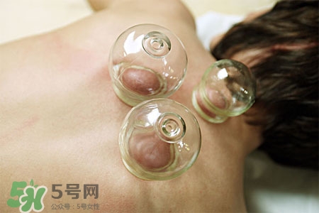 拔罐放血有什么壞處？拔罐放血的危害
