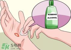 水泡怎么處理？水泡要不要刺破？