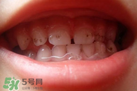 刷牙后吃東西發(fā)苦正常嗎？為什么刷牙后吃東西發(fā)苦？